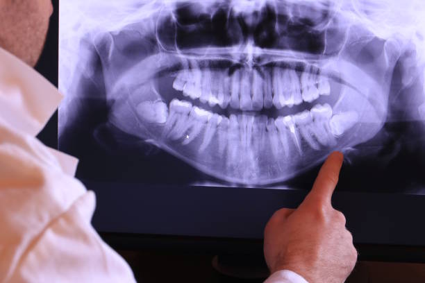 Best Emergency Treatment for Dental Infections or Abscesses in Appleton City, MO