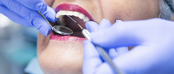 Best Emergency Gum Treatment in Appleton City, MO